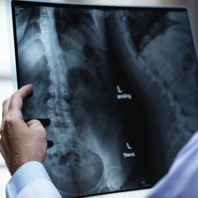 Kommunikation, Krankenhaus, Röntgenbild
